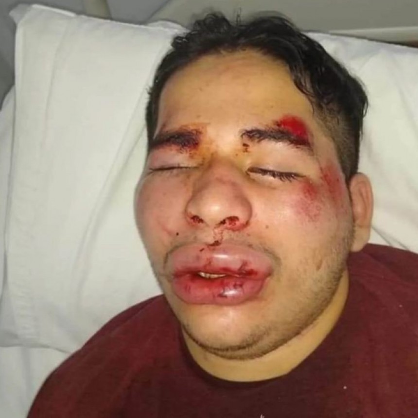 SAN ANTONIO DE ARECO: FAMILIA DE JOVEN BRUTALMENTE GOLPEADO SOLICITA QUE SEA TRASLADADO AL HOSPITAL SAN JOSÉ DE PERGAMINO