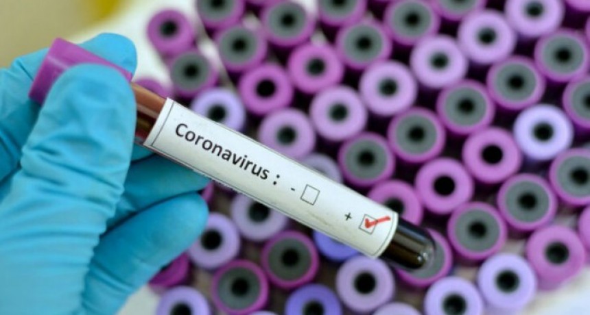 CORONAVIRUS EN LA ARGENTINA: EL GOBIERNO CONFIRMÓ UNA NUEVA MUERTE Y YA SON 34 LAS VÍCTIMAS FATALES