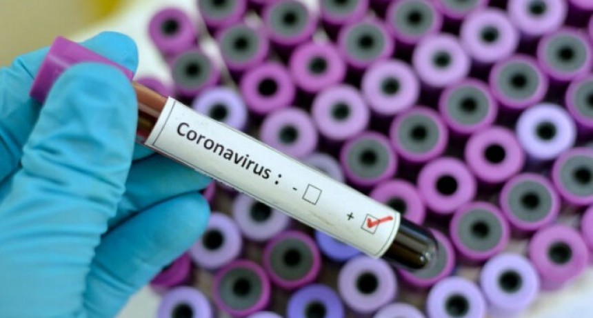 Ya son 48 los muertos en Argentina por coronavirus